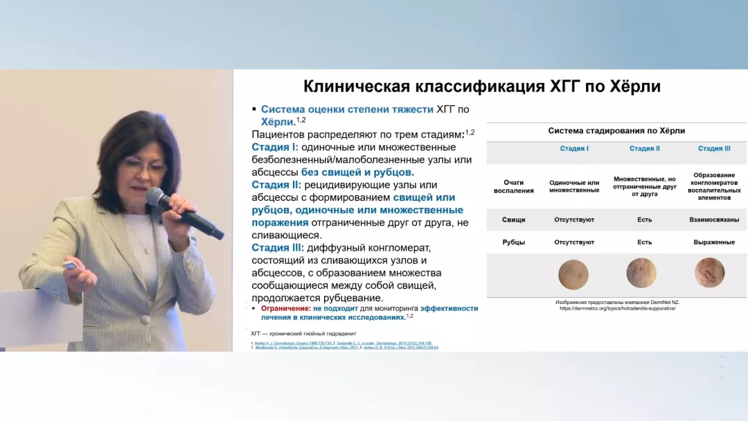 Гнойный гидраденит. Система стадирования по Хёрли/IHS4