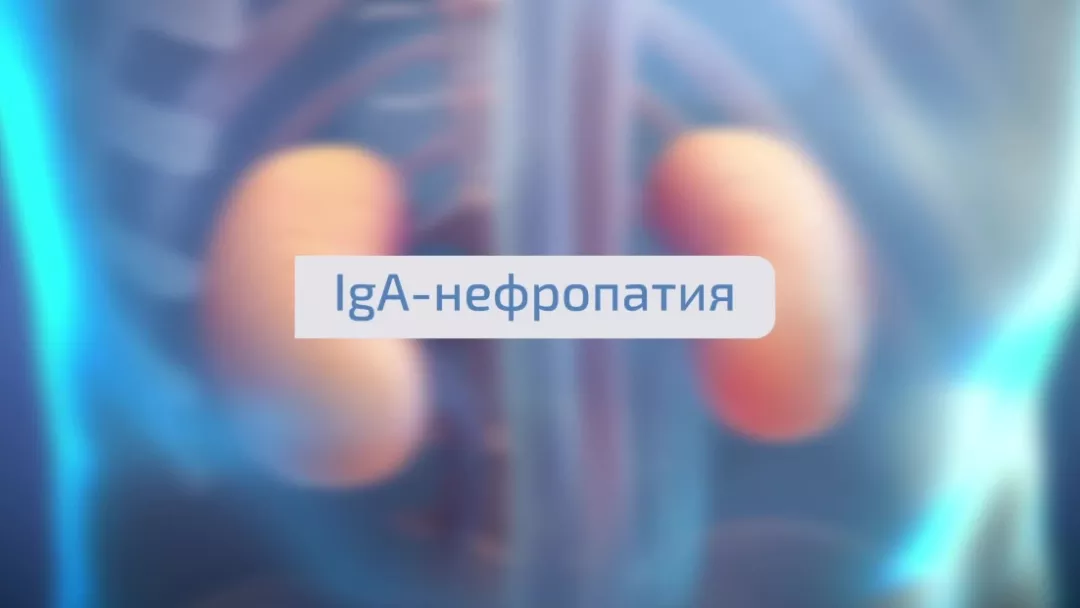 IgA-нефропатия