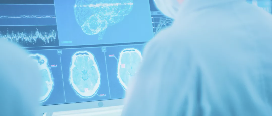 Критерии успеха лечения прогрессирующих форм РС