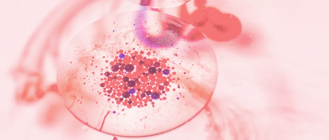 Диагностика ВПРС