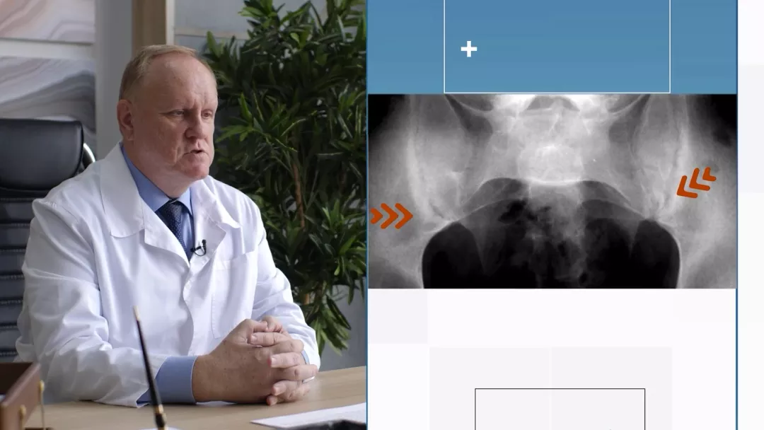 FireShot Capture 250 - Анкилозирующий спондилит - cdnapisec.kaltura.com__0_0.png