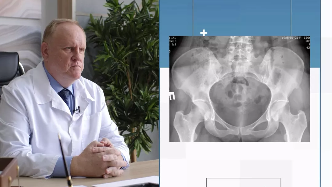 FireShot Capture 251 - Нерентгенологический аксиальный спондилоартрит - cdnapisec.kaltura.com__0.png