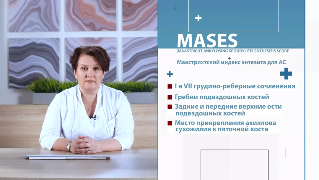 FireShot Capture 257 - Оценка энтезитов у пациента с аксСпА - cdnapisec.kaltura.com__0.png