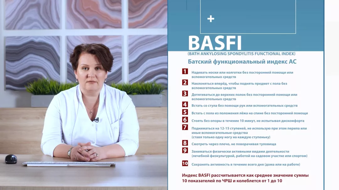 FireShot Capture 259 - Оценка функциональной активности пациента с аксСпА.mp4_ - cdnapisec.kaltura.com__0.png
