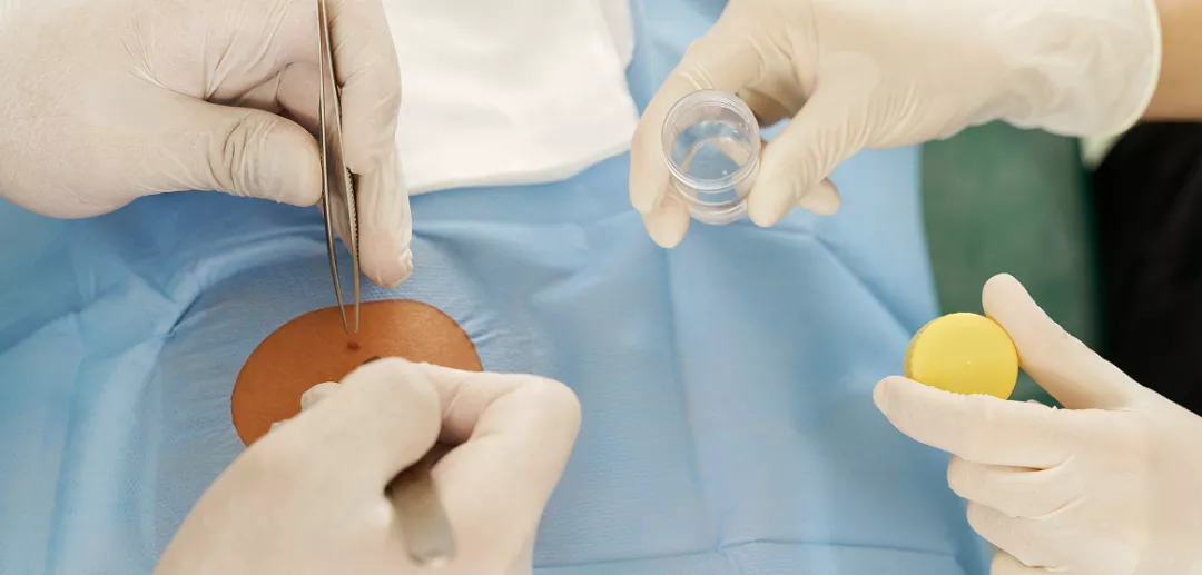 Биопсия почки в практике врача-нефролога: на что обратить внимание?