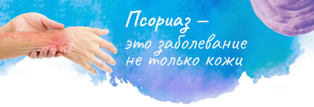 Псориаз - это заболевание не только кожи