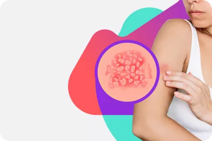 Дерматология