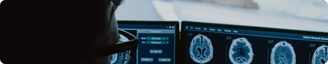 COMBI-MB: Лекарственная терапия пациентов с метастазами меланомы кожи в головной мозг