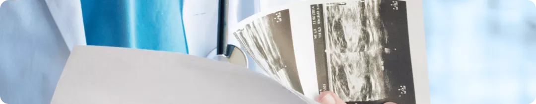 Солидные опухоли с мутацией BRAF V600