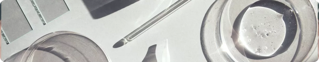 Клинический случай первичного миелофиброза: JAK2V617(+), промежуточный-2 риск DIPSS