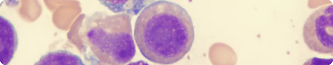 TELESTO: исследование безопасности и эффективности деферазирокса при лечении пациентов с миелодиспластическим синдромом