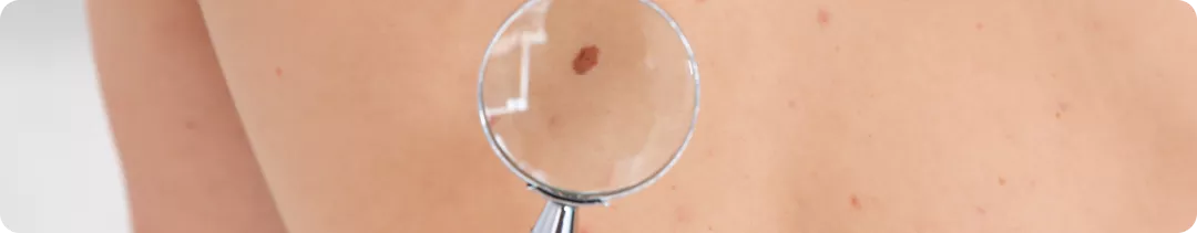 Rechallenge: почему и как работает?