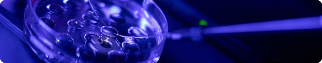 Когда следует делать биопсию у пациентов, перенесших трансплантацию почки вследствие гломерулопатии?