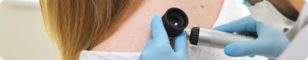 Метастатическая меланома кожи. Что полезного можно извлечь из исследования COMBI-i?