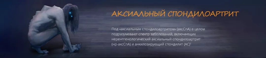 Аксиальный спондилоартрит