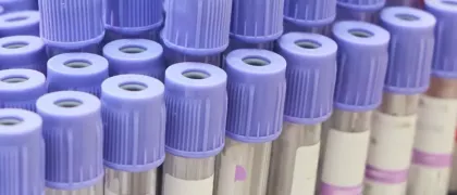 Диагностика липопротеина(а)