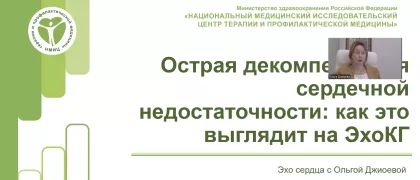 ОДСН на ЭхоКГ