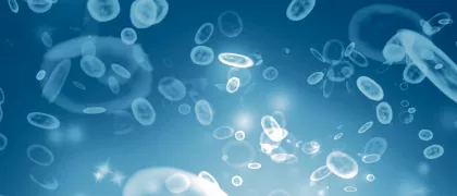 Эпидемиология и подходы к терапии пациентов с МПН в Новосибирской области