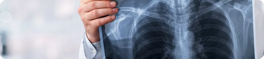 Немелкоклеточный рак легкого