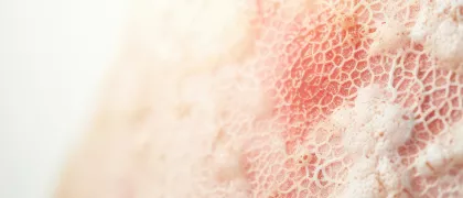 Место рибоциклиба в обновленных алгоритмах лечения 2024