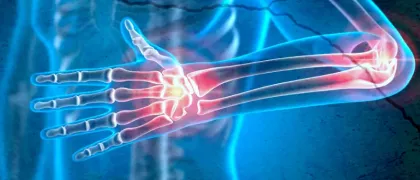 Функция нейтрофилов после лечения пациентов с псориатическим артритом секукинумабом