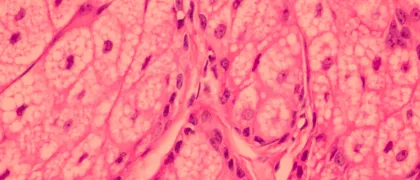 Подготовка образцов к молекулярно-генетическому исследованию