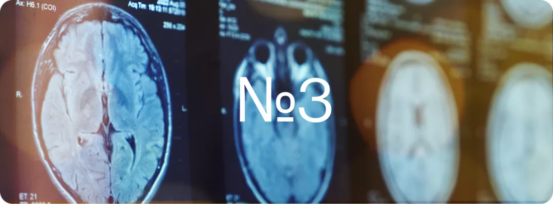 Клинический случай №3
