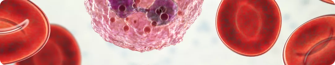 Общая выживаемость пациентов с HR+ HER2− РМЖ, соответствующих критериям включения в исследования NATALEE и monarchE, в реальной клинической практике