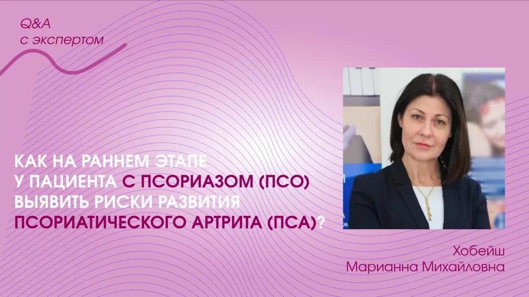 Как на раннем этапе у пациента с псориазом (ПсО) выявить риски развития псориатического артрита (ПсА)
