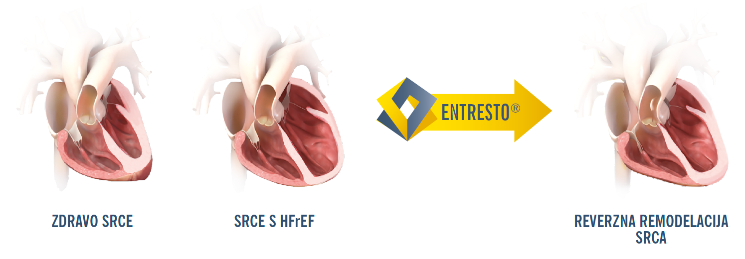 Slika15.png Slika15.png