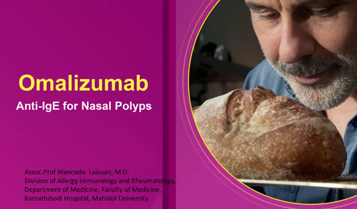 Omalizumab-Anti-IgE-for-Nasal-Polyps
