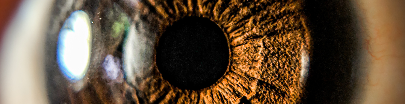 oftalmoloji-ta-ust oftalmoloji-ta-ust