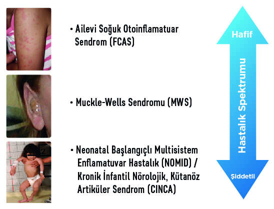caps hastalık spektrumu_0 caps hastalık spektrumu_0