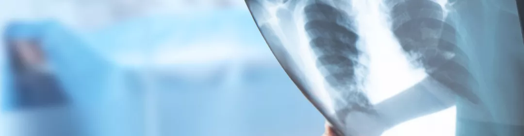 gogus-hastaliklari-ta-ust