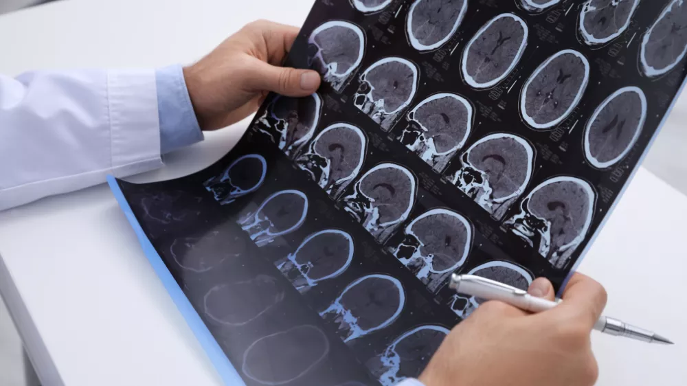 ms-norolojik-muayene