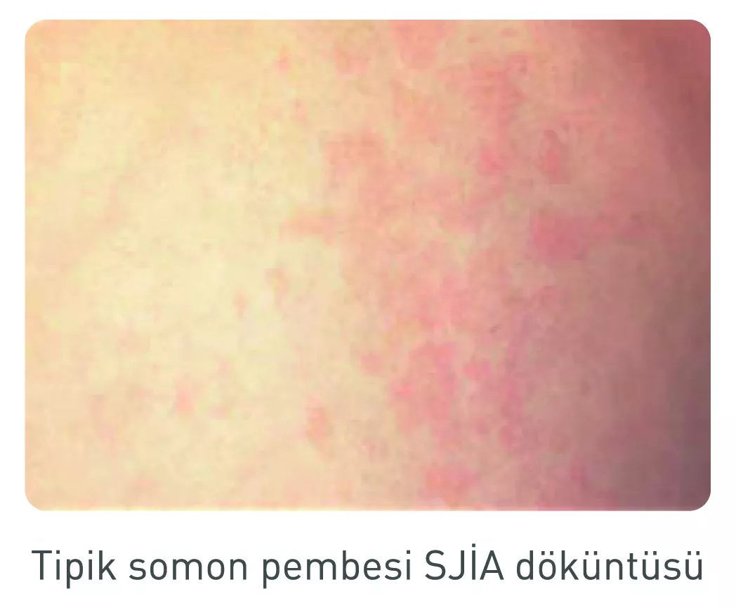 tipik-somon-pembesi-sjia