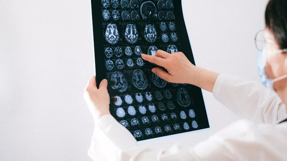 Fingya Etki Mekanizması Fingya Etki Mekanizması