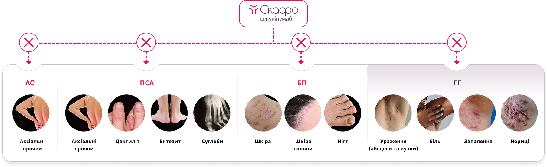 СКАФО блокує IL-17A, ключовий цитокін, відповідальний за запалення, яке лежить в основі БП, АС, ПСА, та ГГ 2 СКАФО блокує IL-17A, ключовий цитокін, відповідальний за запалення, яке лежить в основі БП, АС, ПСА, та ГГ 2