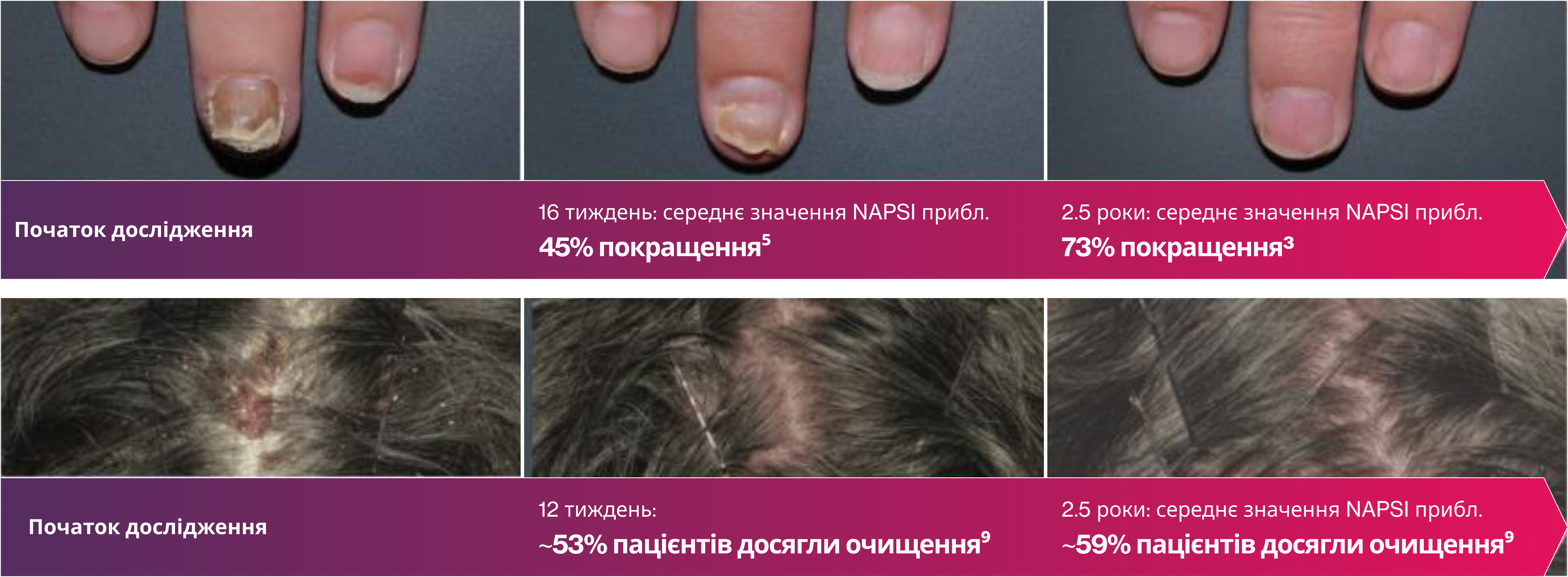 Потужний у ділянках з постійним ураженням Потужний у ділянках з постійним ураженням