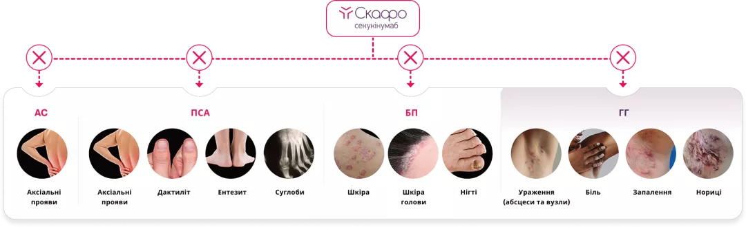 СКАФО блокує IL-17A, ключовий цитокін, відповідальний за запалення, яке лежить в основі БП, АС, ПСА, та ГГ 2