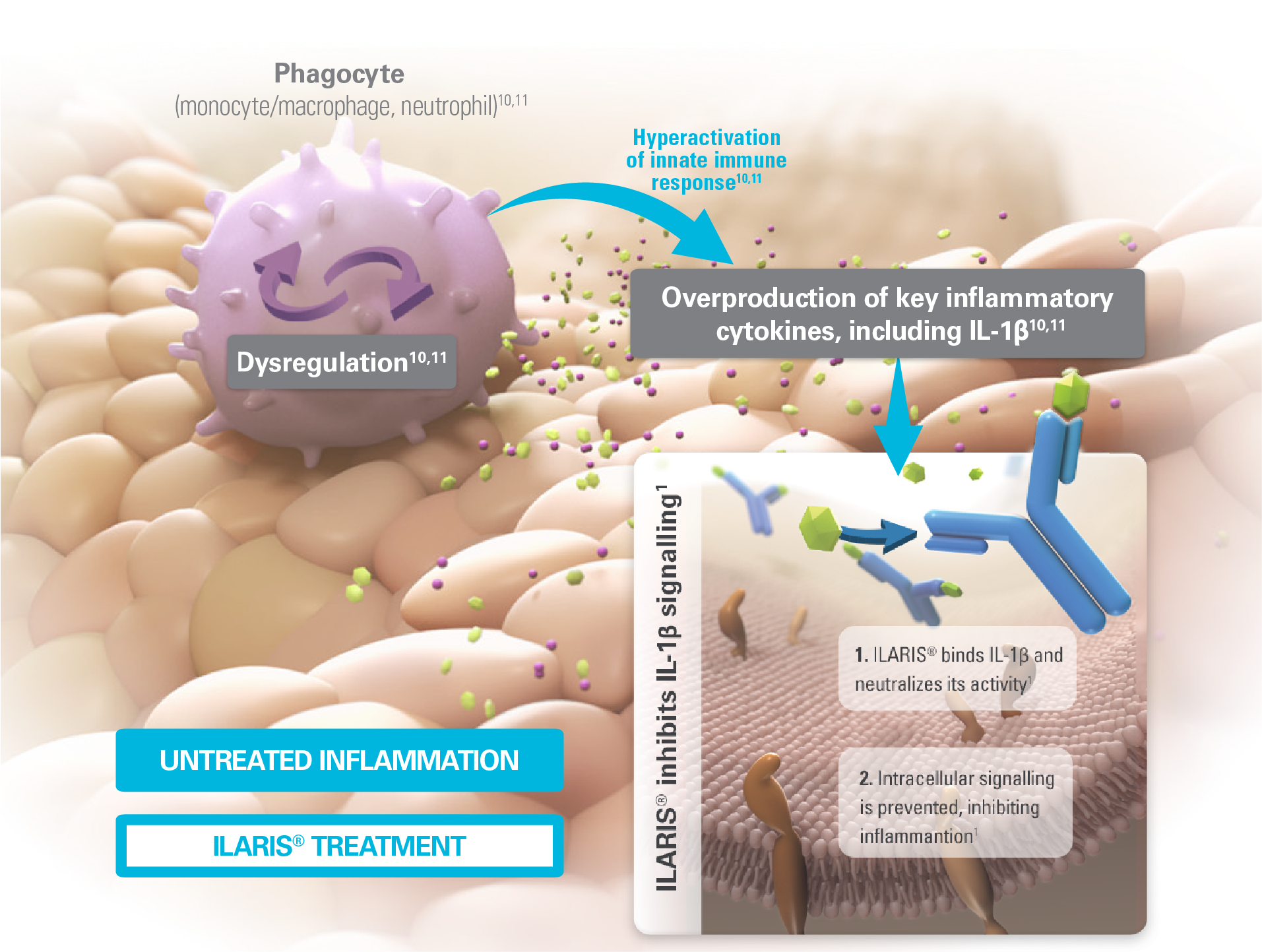 Image showing the mechanism of action of ILARIS in periodic fever syndromes. Image showing the mechanism of action of ILARIS in periodic fever syndromes.
