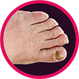 Circular image of a person's foot and toe nails. Circular image of a person's foot and toe nails.