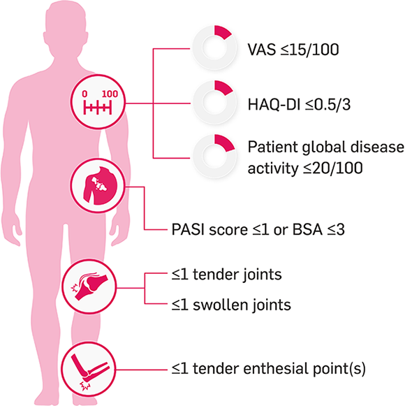 Explanatory graphic for MDA score Explanatory graphic for MDA score