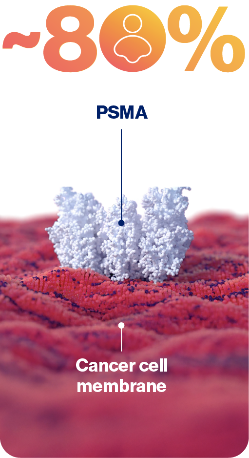 Graphic illustrating that PSMA is highly expressed in ~80% of men with prostate cancer.