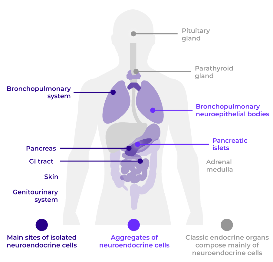Diagram of the abdomen and upper body showing the anatomical classification of NETs.