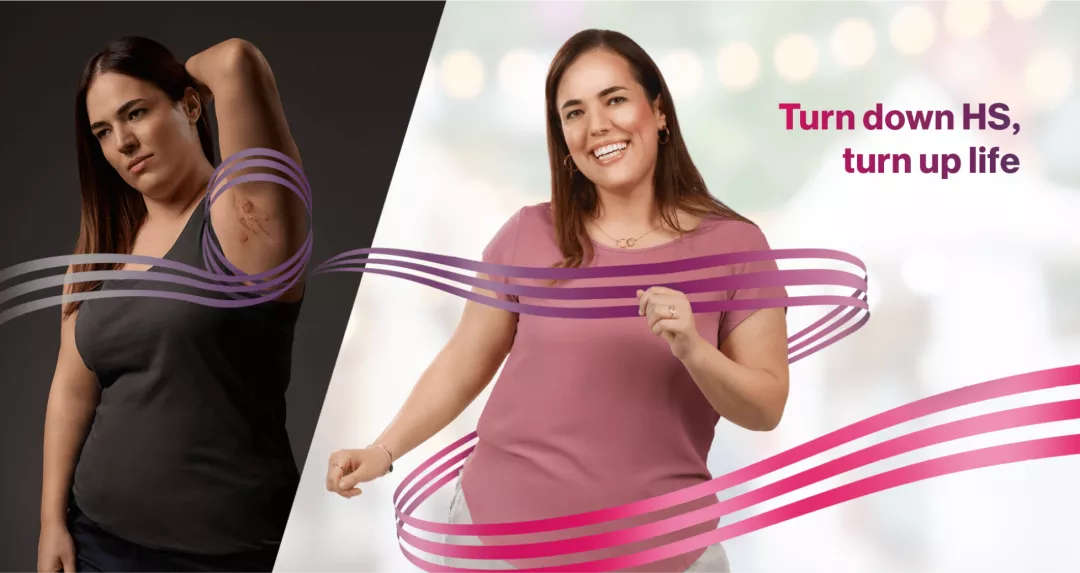 HS brand image of a woman with HS next to a picture of the same woman dancing. Text ‘Turn down HS, turn up life’.
