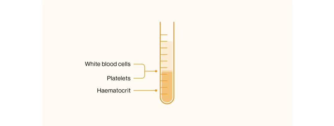 jakavi-about-pv-slider-1