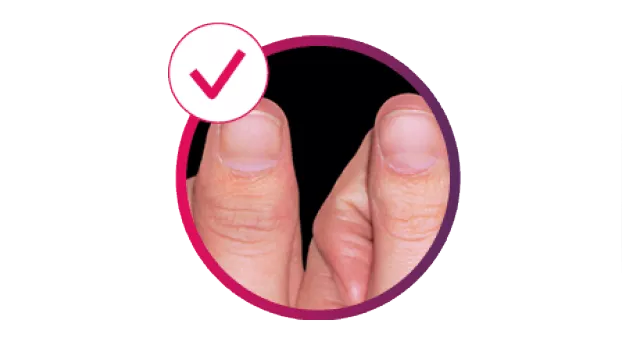 Image depicting dactylitis.