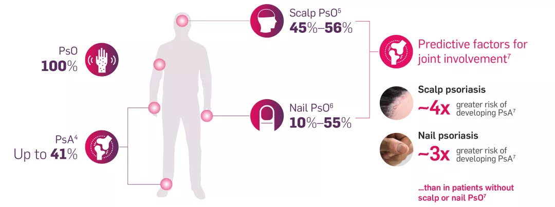 Incidence of clinical manifestations in patients with PsO graphic.