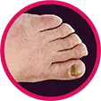 Circular image of a person's foot and toe nails.